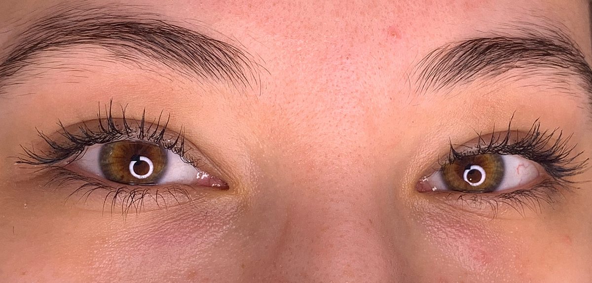 Real client before her brow treatment
